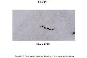 Sample Type : Frog brain Primary Antibody Dilution : 1:500 Secondary Antibody : Biotinylated goat anti-rabbit Secondary Antibody Dilution : 1:200 Color/Signal Descriptions : Black: EGR1 Gene Name : Egr1 a Submitted by : Eva Fischer, Colorado State University (EGR1 anticorps  (C-Term))
