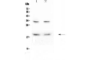 Western blot analysis of Pleiotrophin using anti-Pleiotrophin antibody . (Pleiotrophin anticorps  (AA 33-168))