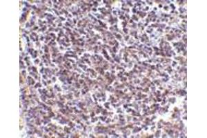Immunohistochemistry of Aven in human spleen tissue with Aven antibody at 5 μg/ml.