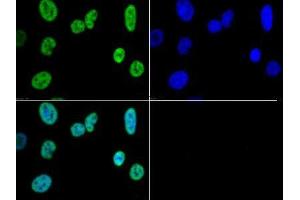 Immunofluorescence of Rabbit Anti-Histone H3 K4/me3 Antibody.