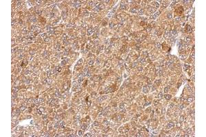 IHC-P Image Immunohistochemical analysis of paraffin-embedded U87 xenograft, using alpha Actin (smooth muscle), antibody at 1:500 dilution.