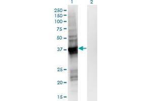 Western Blot analysis of GIPC2 expression in transfected 293T cell line by GIPC2 monoclonal antibody (M02), clone 4H8. (GIPC2 anticorps  (AA 1-315))