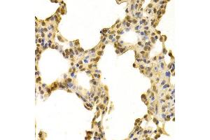 Immunohistochemistry (IHC) image for anti-DNA-Damage-Inducible Transcript 3 (DDIT3) (C-Term) antibody (ABIN3020710) (DDIT3 anticorps  (C-Term))