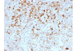Formalin-fixed, paraffin-embedded human Pituitary stained with LH-beta Mouse Monoclonal Antibody (LHb/1214). (LHB anticorps)