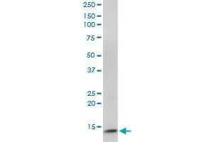 CIDEC monoclonal antibody (M07), clone 2E2. (CIDEC anticorps  (AA 53-141))