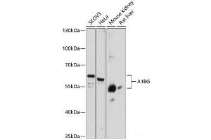 Western blot analysis of extracts of various cell lines using A1BG Polyclonal Antibody at dilution of 1:3000. (A1BG anticorps)