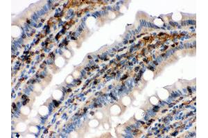 Anti- Cofilin Picoband antibody, IHC(P) IHC(P): Rat Intestine Tissue