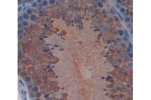 IHC-P analysis of Mouse Tissue, with DAB staining. (Hexokinase 1 anticorps  (AA 137-270))