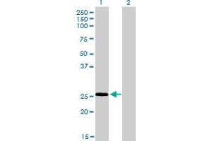 Western Blotting (WB) image for anti-Ring Finger Protein 141 (RNF141) (AA 141-230) antibody (ABIN599236) (RNF141 anticorps  (AA 141-230))