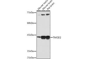 Western blot analysis of extracts of various cell lines, using TMOD2 Rabbit mAb (ABIN7271011) at 1:1000 dilution. (TMOD2 anticorps)