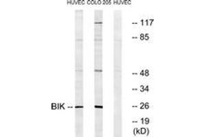 Western Blotting (WB) image for anti-BCL2-Interacting Killer (Apoptosis-Inducing) (BIK) (AA 18-67) antibody (ABIN2888586) (BIK anticorps  (AA 18-67))