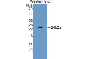 Detection of Recombinant CDNF, Rat using Polyclonal Antibody to Cerebral Dopamine Neurotrophic Factor (CDNF)