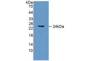 Detection of Recombinant BCKDK, Rat using Polyclonal Antibody to Branched Chain Alpha-Ketoacid Dehydrogenase Kinase (BCKDK) (BCKDK anticorps  (AA 44-223))