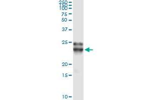 Immunoprecipitation of FGF21 transfected lysate using anti-FGF21 monoclonal antibody and Protein A Magnetic Bead , and immunoblotted with FGF21 MaxPab rabbit polyclonal antibody. (FGF21 anticorps  (AA 30-209))