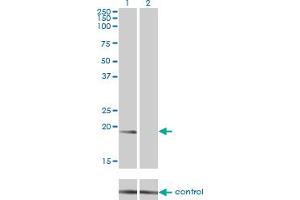Western blot analysis of NME1 over-expressed 293 cell line, cotransfected with NME1 Validated Chimera RNAi (Lane 2) or non-transfected control (Lane 1). (NME1 anticorps  (AA 1-152))