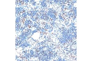 Immunohistochemistry of paraffin-embedded rat spleen using AQR antibody (ABIN6133411, ABIN6137057, ABIN6137058 and ABIN6221662) at dilution of 1:100 (40x lens).