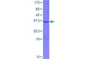 Image no. 1 for Autophagy related 4D Cysteine Peptidase (ATG4D) (AA 1-141) protein (GST tag) (ABIN1345976)