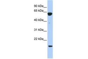 Image no. 1 for anti-Protein Tyrosine Phosphatase Type IVA, Member 3 (PTP4A3) (C-Term) antibody (ABIN6743577) (PTP4A3 anticorps  (C-Term))