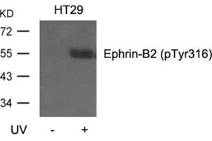 Western blot analysis of extracts from HT29 cells, untreated or treated with UV using Ephrin-B2(Phospho-Tyr316) Antibody. (Ephrin B2 anticorps  (pTyr316))