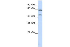 WB Suggested Anti-ChGn Antibody Titration:  0. (CSGALNACT1 anticorps  (C-Term))