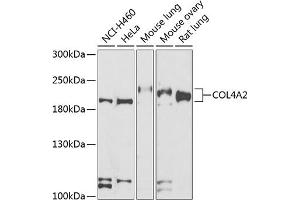 Western blot analysis of extracts of various cell lines, using COL4 antibody (ABIN6134493, ABIN6138843, ABIN6138844 and ABIN6223578) at 1:500 dilution. (COL4a2 anticorps  (AA 1486-1712))