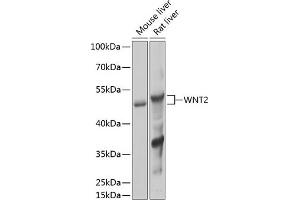 Western blot analysis of extracts of various cell lines, using WNT2 Antibody (ABIN6134457, ABIN6150238, ABIN6150240 and ABIN6217609) at 1:1000 dilution. (WNT2 anticorps  (AA 1-100))