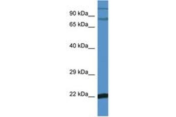 NFKBIZ antibody  (C-Term)