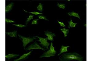 Immunofluorescence of monoclonal antibody to SEC63 on HeLa cell. (SEC63 anticorps  (AA 631-728))