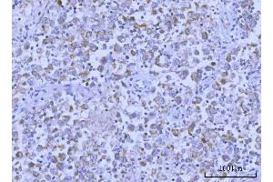 IHC analysis of Hamartin/TSC1 using anti-Hamartin/TSC1 antibody (ABIN7599499). (TSC1 anticorps  (AA 1-618))
