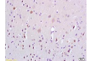 Formalin-fixed and paraffin embedded rat brain tissue labeled with Anti-ERK4 Polyclonal Antibody, Unconjugated (ABIN754288) at 1:200 followed by conjugation to the secondary antibody and DAB staining (MAPK7 anticorps  (AA 401-500))