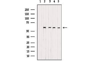 Western blot analysis of extracts from various samples, using CS061 Antibody. (SMG9 anticorps  (Internal Region))