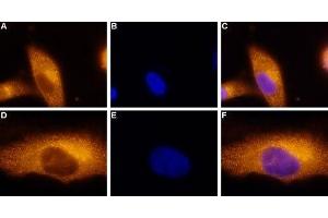 Expression of Adenosine A3 Receptor in a human melanoma cell line - Immunocytochemical staining of paraformaldehyde-fixed and permeabilized  human melanoma cells (A2058).