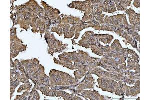 IHC analysis of VPS53 using anti-VPS53 antibody (ABIN7599731). (VPS53 anticorps  (AA 11-699))