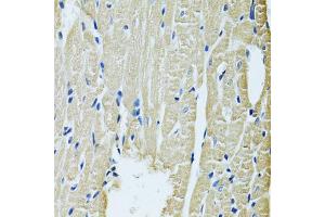 Immunohistochemistry of paraffin-embedded rat heart using SLC5A6 antibody (ABIN6292573) at dilution of 1:100 (40x lens).