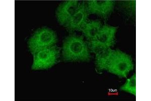 Immunofluorescence analysis of paraformaldehyde-fixed A549, using GAPDH antibody at 1:200 dilution. (GAPDH anticorps  (AA 9-323))