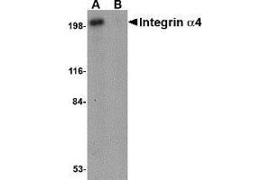 Western blot analysis of Integrin alpha 4 in Jurkat cell lysate with AP30434PU-N Integrin alpha 4 antibody at 1 μg/ml in (A) the absence and (B) the presence of blocking peptide. (ITGA4 anticorps  (C-Term))