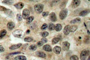 Image no. 1 for anti-Cell Division Cycle 25 Homolog C (S. Pombe) (CDC25C) antibody (ABIN265342) (CDC25C anticorps)