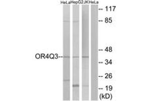 Western Blotting (WB) image for anti-Olfactory Receptor, Family 4, Subfamily Q, Member 3 (OR4Q3) (AA 264-313) antibody (ABIN2891015) (OR4Q3 anticorps  (AA 264-313))
