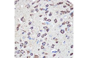 Immunohistochemistry of paraffin-embedded Rat brain using LRRK2 Rabbit pAb  at dilution of 1:100 (40x lens). (LRRK2 anticorps  (AA 2355-2527))