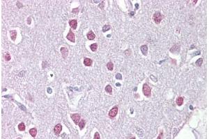 Anti-ETV1 / ER81 antibody IHC staining of human brain, cerebellum. (ETV1 anticorps  (C-Term))