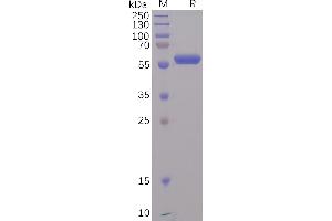 SARS-CoV-2 (2019-nCoV) S protein RBD, mFc Tag on SDS-PAGE under reducing condition.