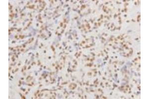 Immunohistochemistry (Paraffin-embedded Sections) (IHC (p)) image for anti-Protein Kinase, DNA-Activated, Catalytic Polypeptide (PRKDC) (Catalytic Subunit) antibody (ABIN1854884)