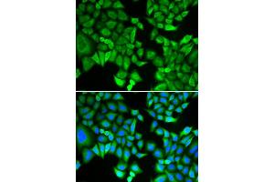 Immunofluorescence analysis of A549 cell using KPNA2 antibody. (KPNA2 anticorps)