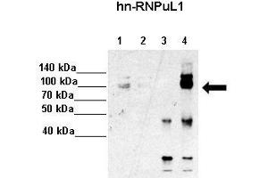 Amount and Sample Type :  Lane 1: 5% InputLane 2: 5% SupLane 3: Normal IgGLane 4: hn-RNPUL1 ppt.