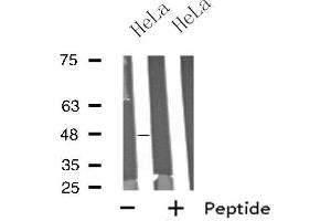 Western blot analysis of extracts from HeLa cells using SCTR antibody. (SCTR anticorps  (Internal Region))