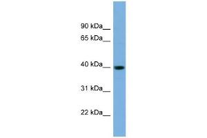 SAE1 antibody used at 1 ug/ml to detect target protein. (SAE1 anticorps  (N-Term))