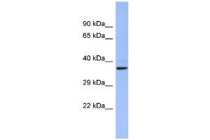WB Suggested Anti-CHRFAM7A Antibody Titration:  0.
