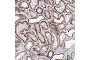 Immunohistochemical staining of human kidney with XPO6 polyclonal antibody  shows strong cytoplasmic positivity in cells of tubules. (Exportin 6 anticorps)