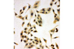 Anti-NRG1 antibody, ICC ICC: HELA Cell