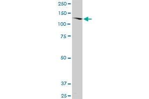 SORCS2 monoclonal antibody (M03), clone 1D7.